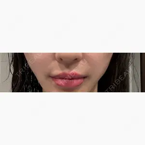 PRO CLINIC プロクリニック 銀座院口コミ