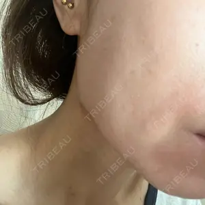 Wi Clinic（ウィ クリニック） 大宮院口コミ