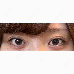 湘南美容クリニック 池袋東口院口コミ