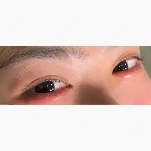 HAAB×DREAM BEAUTY CLINIC 大阪梅田院口コミ