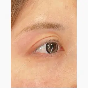 HAAB×DREAM BEAUTY CLINIC 大阪梅田院口コミ