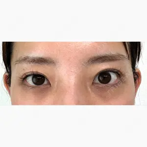 湘南美容クリニック 池袋東口院口コミ