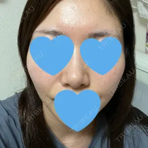 やさしい美容皮膚科・皮フ科　秋葉原院口コミ