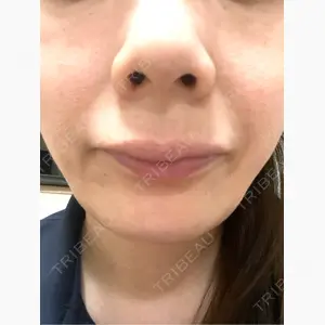 YBC横浜美容外科 立川院口コミ
