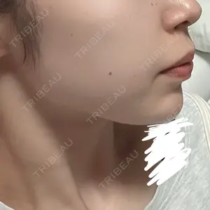 ルラ美容クリニック 岡山院口コミ