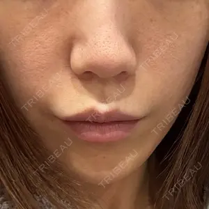 PRO CLINIC プロクリニック 銀座院口コミ