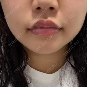 銀座美容外科クリニック 銀座院口コミ