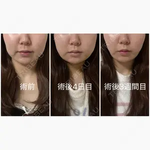 湘南美容クリニック 町田院口コミ