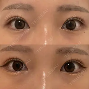 湘南美容クリニック 池袋東口院口コミ