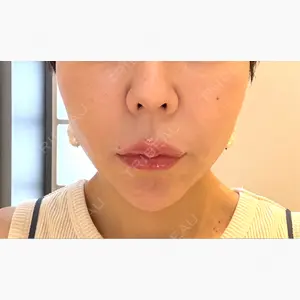 GLAMRULE CLINIC (グラムルール クリニック) 銀座院口コミ