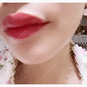 GRACIA clinic 【グラシアクリニック】口コミ