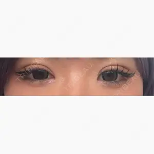 LUHO（ルホ）美容外科口コミ