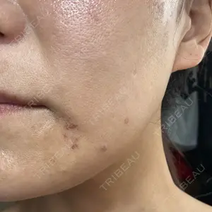 ルラ美容クリニック 広島院口コミ
