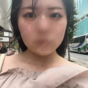 藤・ナチュレ美容クリニック 銀座院口コミ