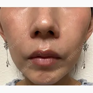 フィラークリニック 福岡院口コミ