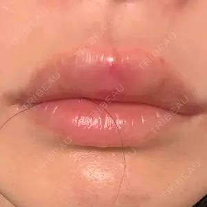 新宿Ladies&Gentlemen美容クリニック口コミ