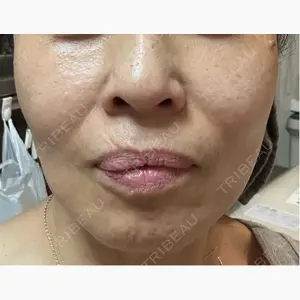 Natural Skin Clinic 笹塚院口コミ
