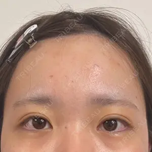 LUHO（ルホ）美容外科口コミ