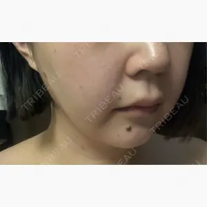 Wi Clinic （ウィ クリニック）心斎橋院口コミ