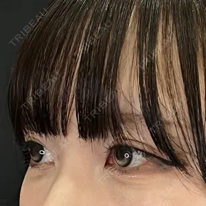 藤・ナチュレ美容クリニック 銀座院口コミ