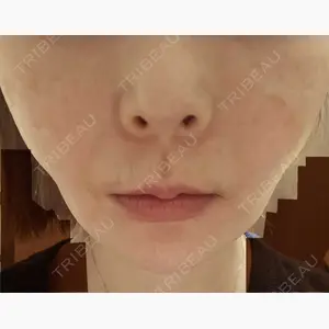 PRO CLINIC プロクリニック 銀座院口コミ