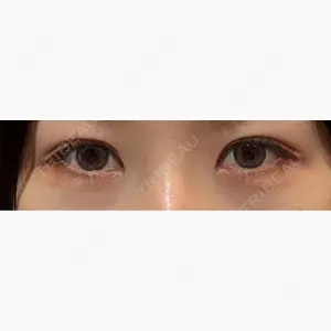 LUHO（ルホ）美容外科口コミ