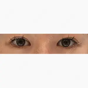 LUHO（ルホ）美容外科口コミ