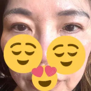 BELINDA CLINIC（ベリンダクリニック）岡山院口コミ