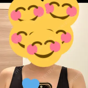 BiBiクリニック口コミ