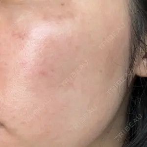MIO CLINIC 梅田院口コミ