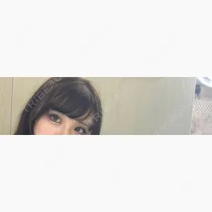 ハナビューティークリニック口コミ