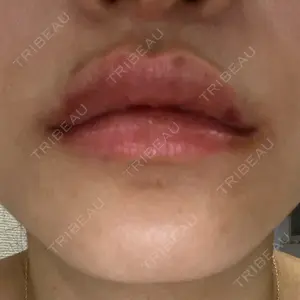 ルラ美容クリニック 岐阜院口コミ