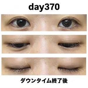 ルネッサンス美容外科医院 青山本院口コミ