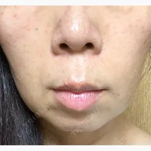 ルラ美容クリニック 渋谷本院口コミ