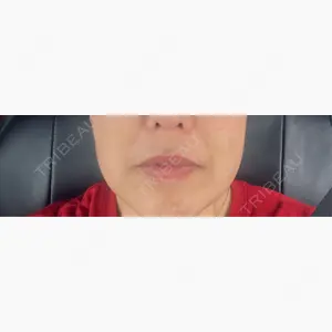 Natural Skin Clinic 笹塚院口コミ
