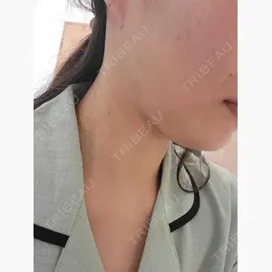 アムルーズ美容外科クリニック 横浜院口コミ