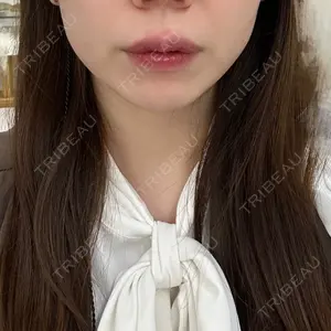 フォンタナクリニック天神口コミ