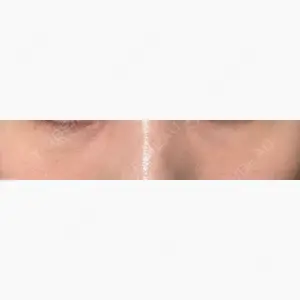 マルーンビューティースキンクリニック口コミ