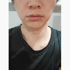 ルラ美容クリニック 名古屋本院口コミ