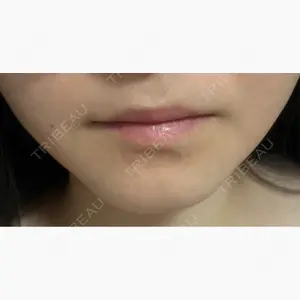 PRISM Beauty Clinic口コミ