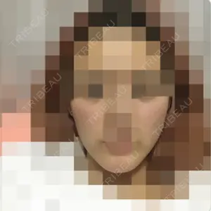 ニューセンス皮膚科クリニック口コミ