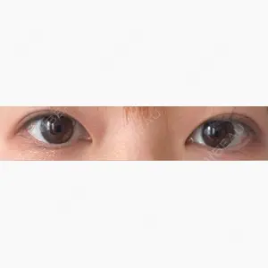 LUHO（ルホ）美容外科口コミ
