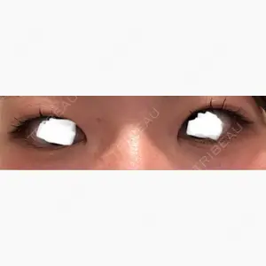 LUHO（ルホ）美容外科口コミ