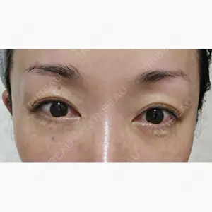 TCB東京中央美容外科 青森院口コミ