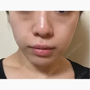 LIBER CLINIC口コミ