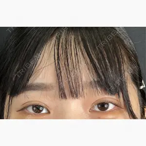 藤・ナチュレ美容クリニック 銀座院口コミ
