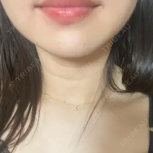 フォンタナクリニック天神口コミ