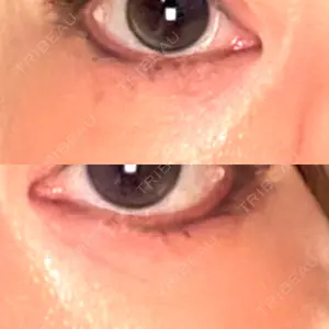 スマートスキンクリニック 神保町院口コミ