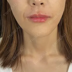 藤・ナチュレ美容クリニック 銀座院口コミ