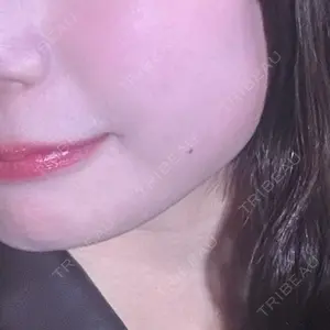 ネビュラクリニック 広島院口コミ